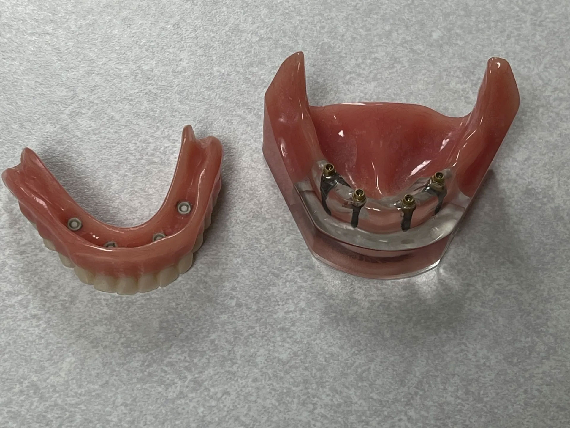 Dental Implants #2